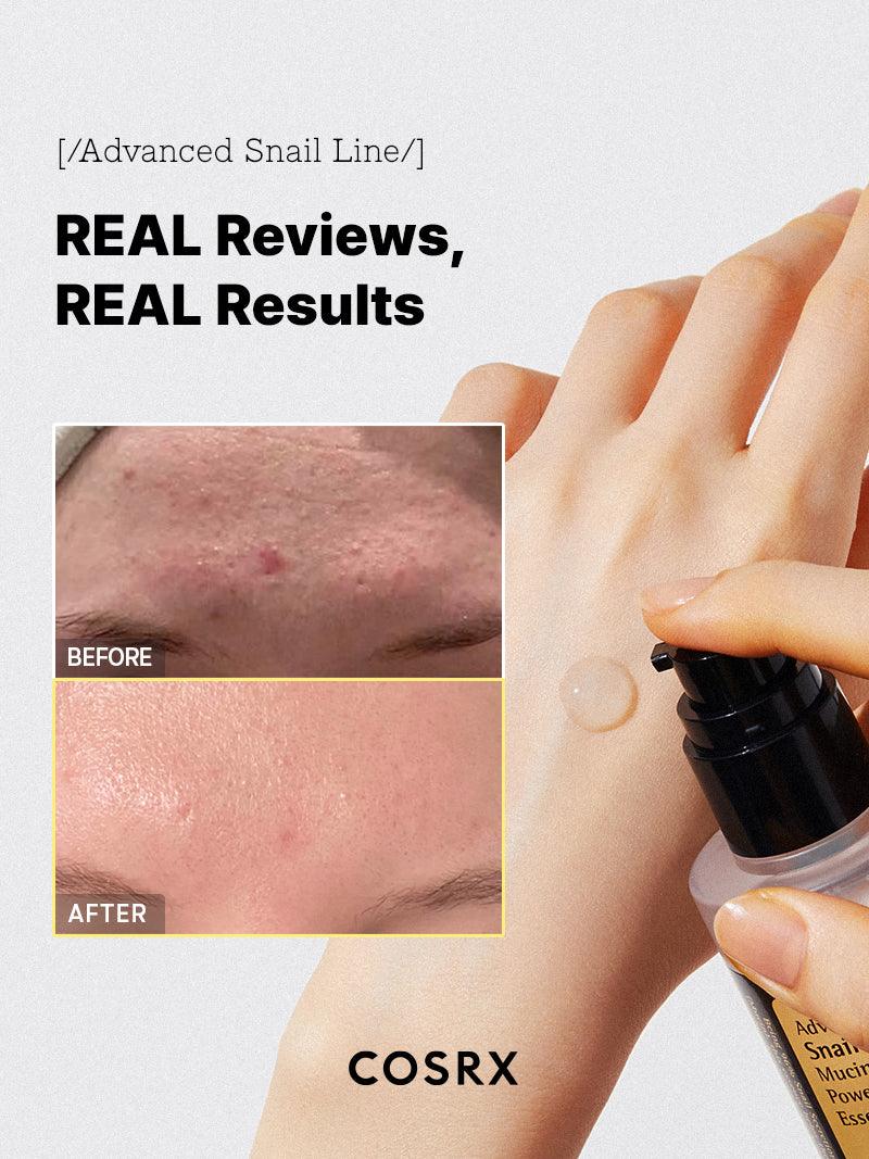 Advanced Snail 96 Mucin Power Essence 100mL - COSRX / Esencia hidratante para el rostro