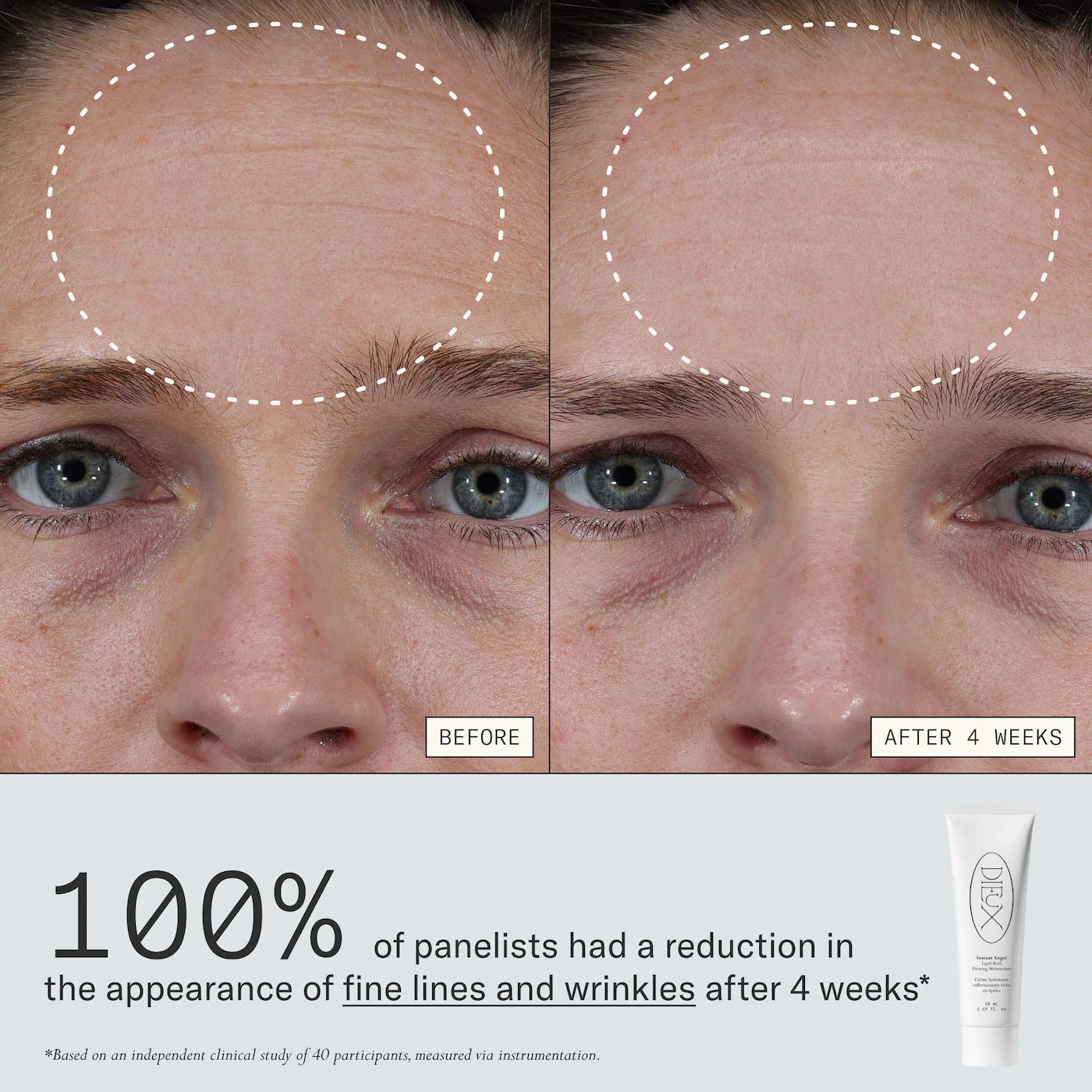 *PREORDEN: Plump + Barrier Boost Kit - Dieux / Set para reducir líneas finas y arrugas.