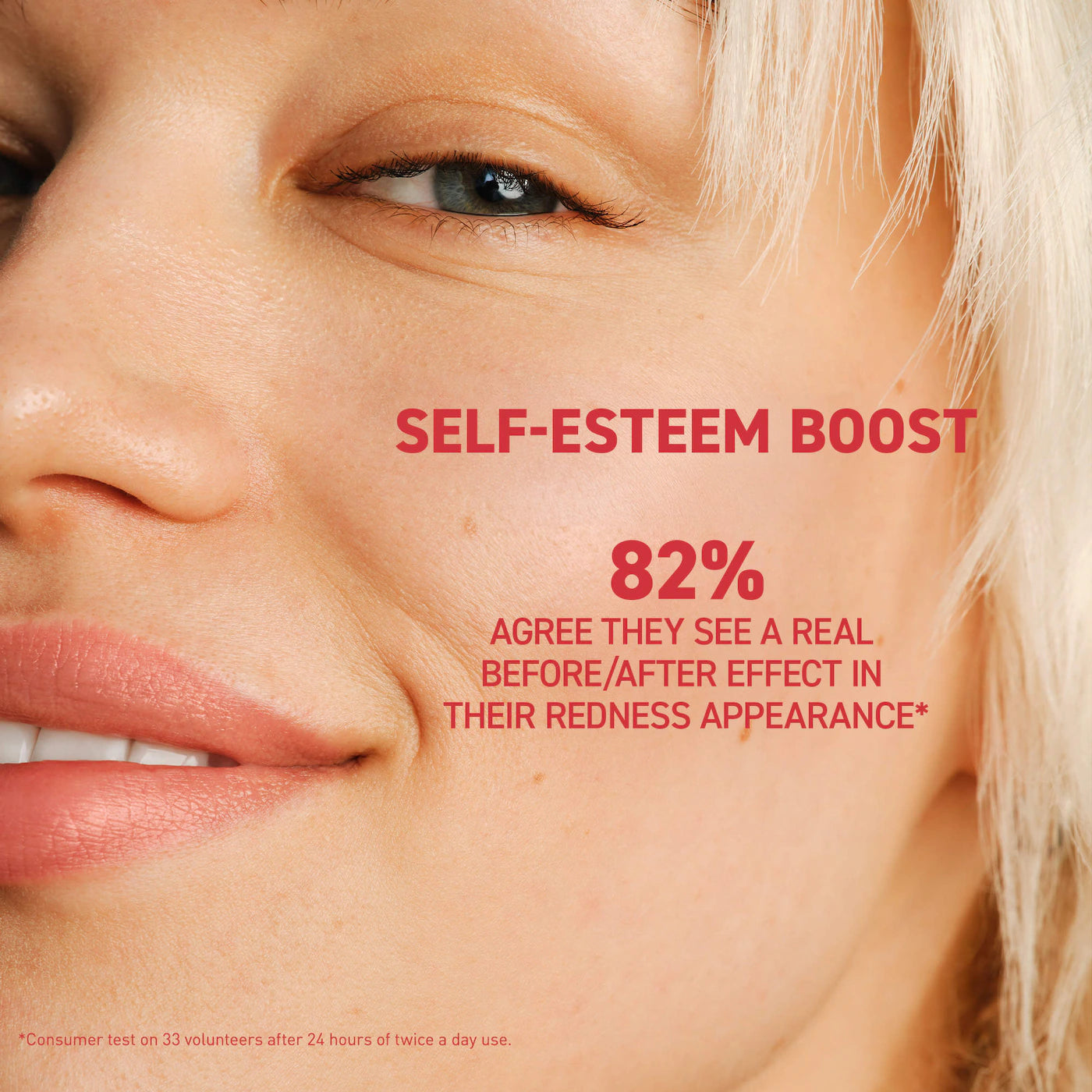 *PREORDEN: Centella Red Serum for Visible Redness & Immediate Soothing Effect on Sensitive Skin - Erborian / Sérum de Centella Roja para piel sensible