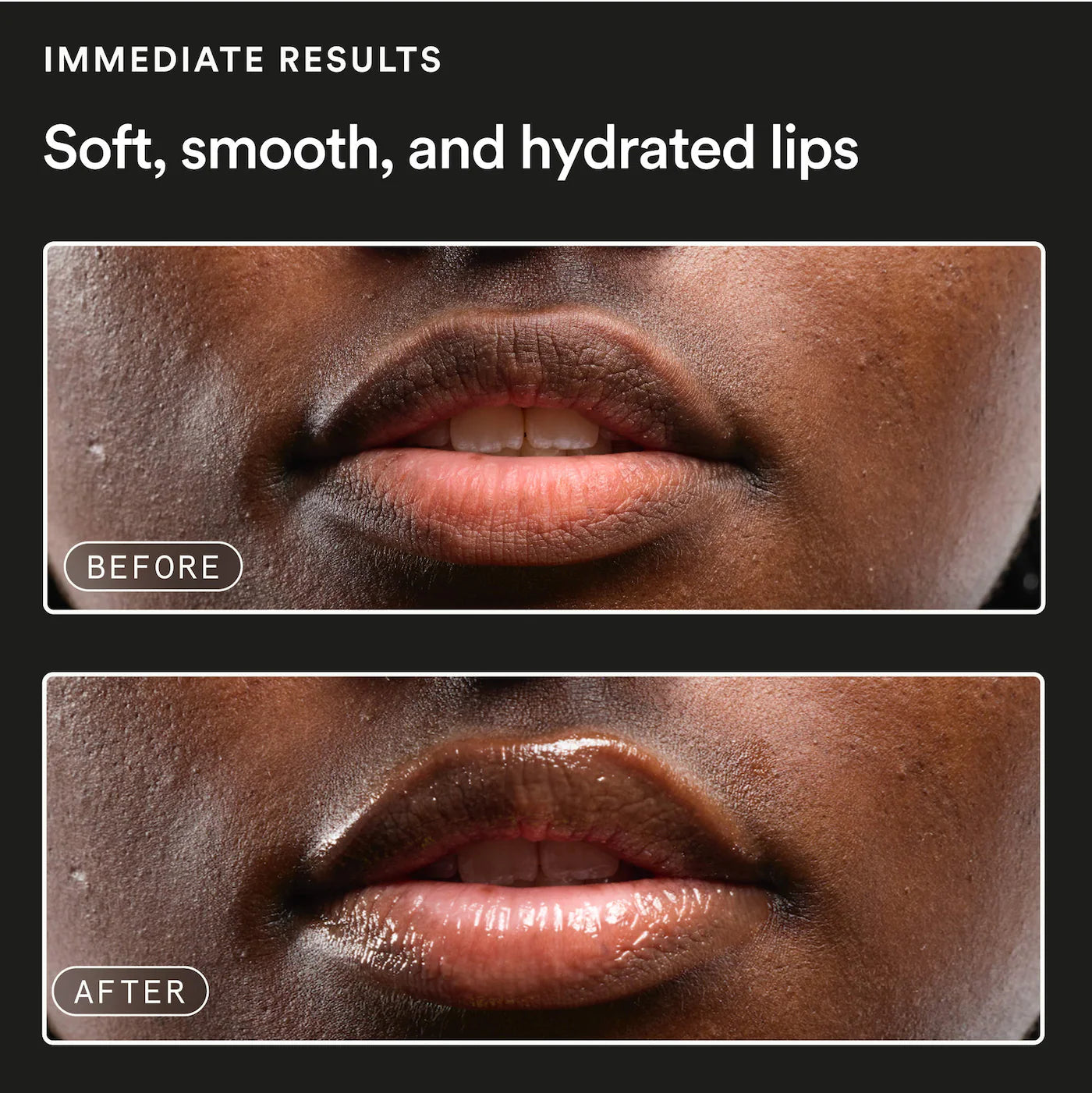*PREORDEN: Softwear Exfoliating and Hydrating Daily Lip Treatment with Squalane + AHA - Experiment / Labial hidratante y exfoliante