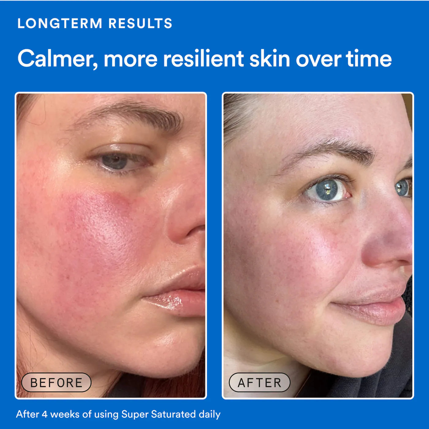 *PREORDEN: Super Saturated Hydrating Barrier Serum with 30% Glycerin + Polyglutamic Acid - Experiment / Suero hidratante intensivo