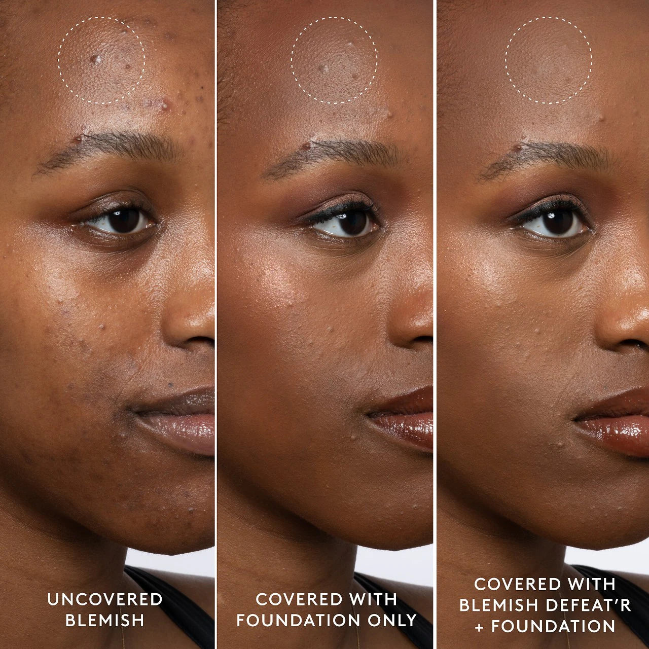 Blemish Defeat'r BHA Spot-Targeting Gel - Fenty Skin / Gel para manchas e imperfecciones