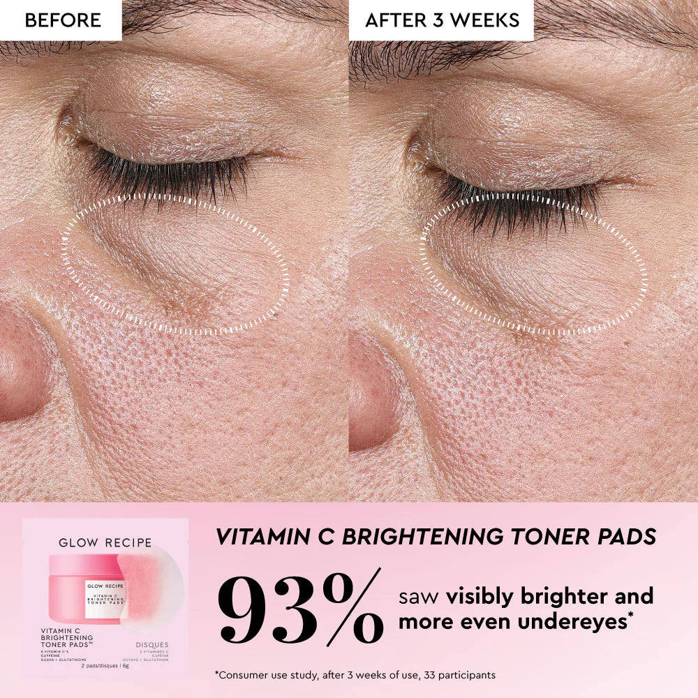 *PREORDEN: Korean Toner Pad Skin Care Kit for Pores, Dark Spots, and Skin Barrier Repair - Glow Recipe / Set de cuidado facial coreano