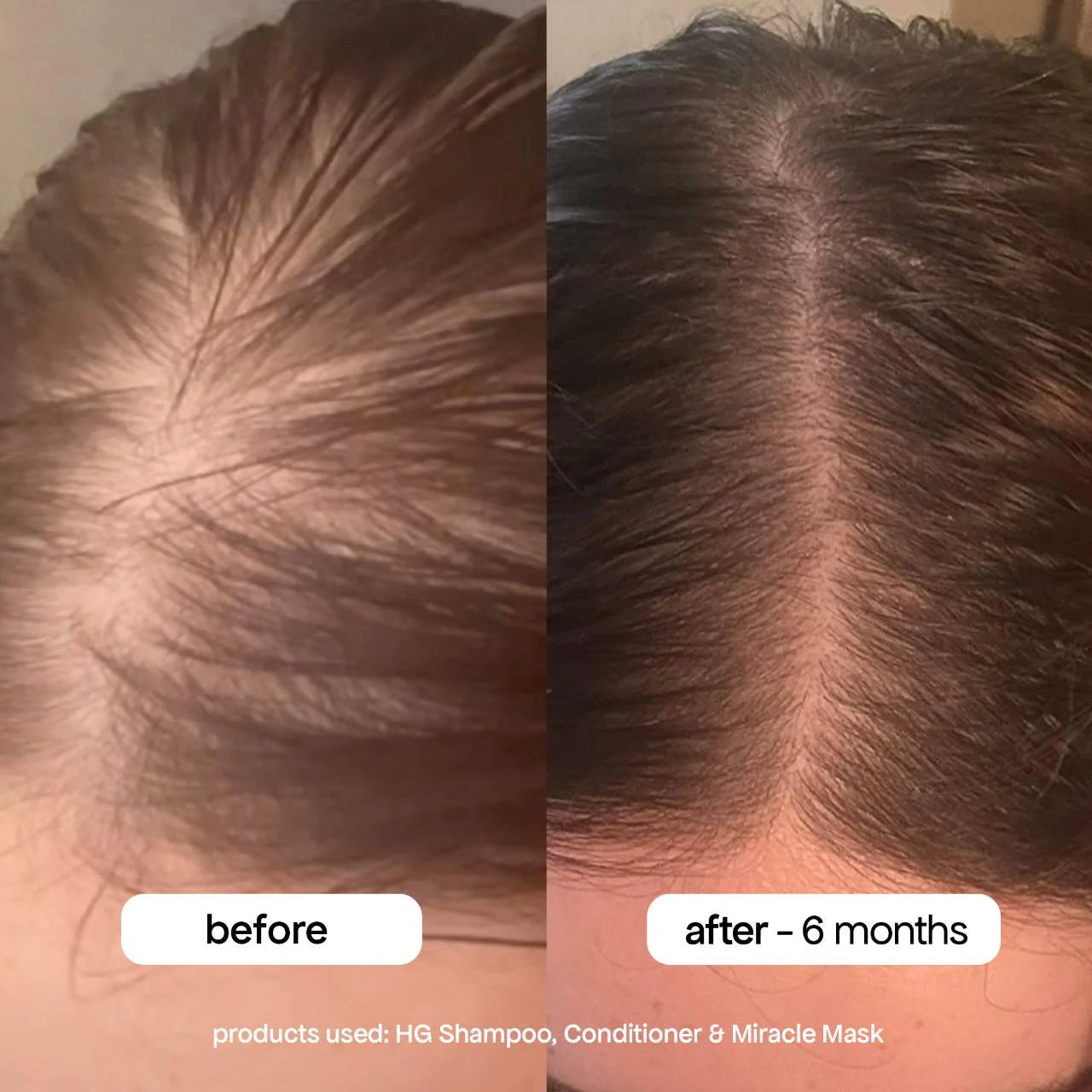 *PREORDEN: HG Miracle Hair Mask with Rosemary for Hair Thinning - BondiBoost / Mascarilla profunda para cabello saludable