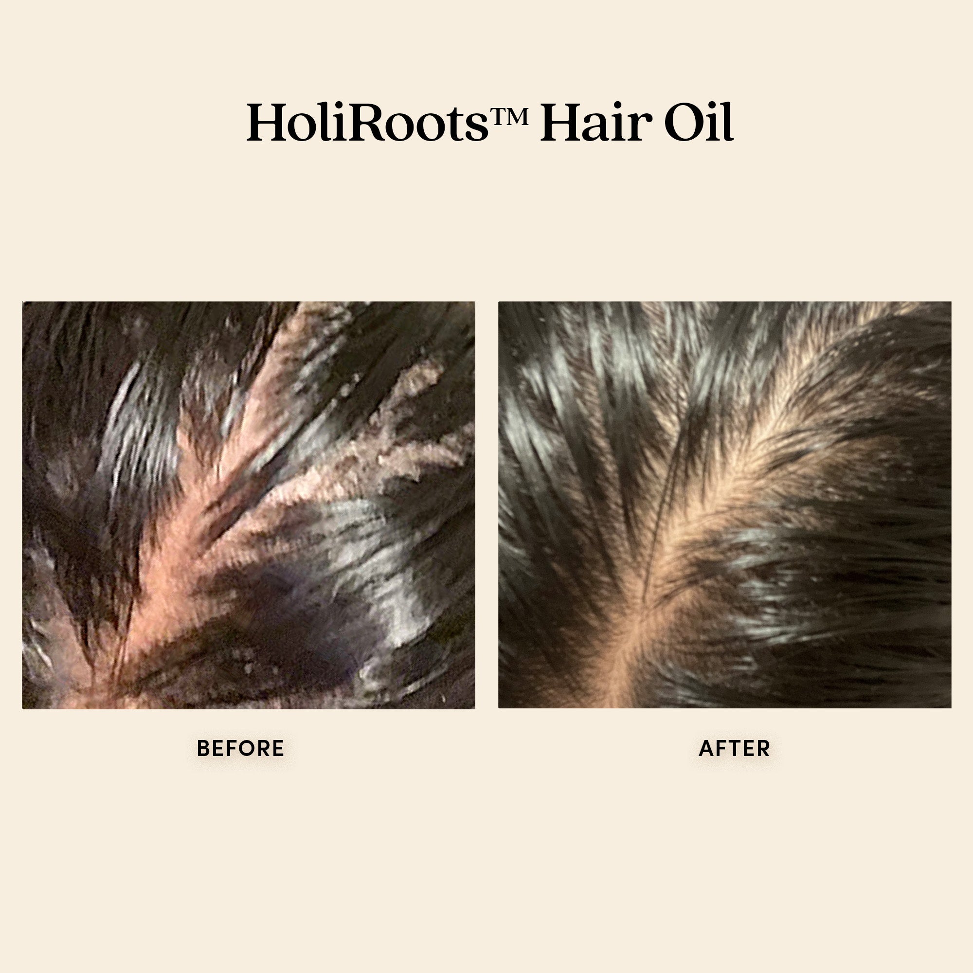 HoliRoots™ Pre-wash Hair Treatment Oil - Fable & Mane / Aceite para prelavado fortalecedor de cabello