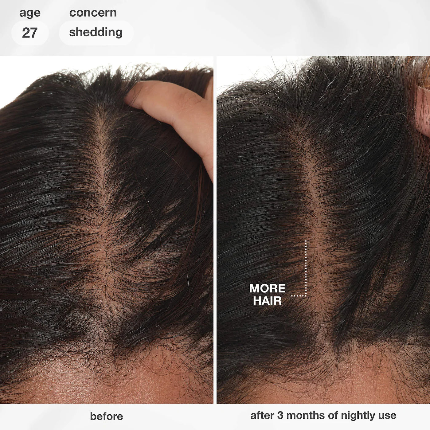 *PREORDEN: FutureIQ™ Hair Longevity Serum for Graying, Thinning, & Scalp Aging - K18 Biomimetic Hairscience / Sérum Nocturno para Canas y Caída del Cabello