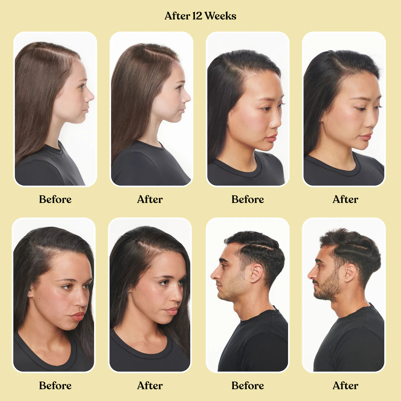 *PREORDEN: Lemme Grow Capsules - lemme / Gomitas para el crecimiento del cabello