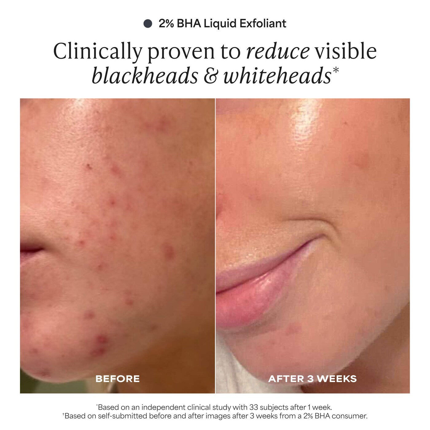 *PREORDEN: Plump + Glow Skincare Trio with 2% BHA & Peptides for Smoother, Firmer Skin - Paula's Choice / Set de cuidado de la piel