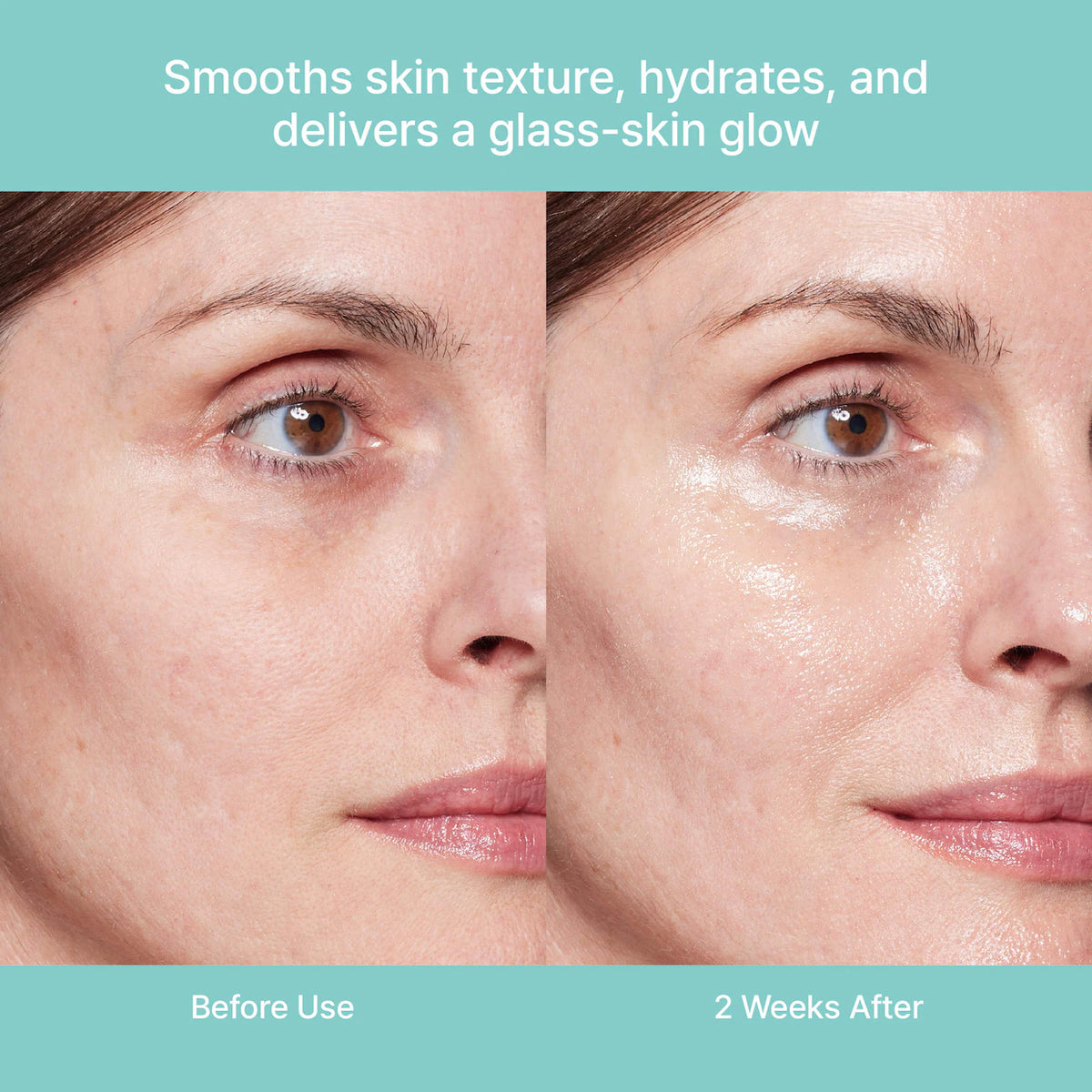 *PREORDEN: Turnover Ampoule c-PDRN® 0.5% Renewing Serum for Smooth Texture & Glass Skin - Rejuran / Suero que mejora la textura de la piel