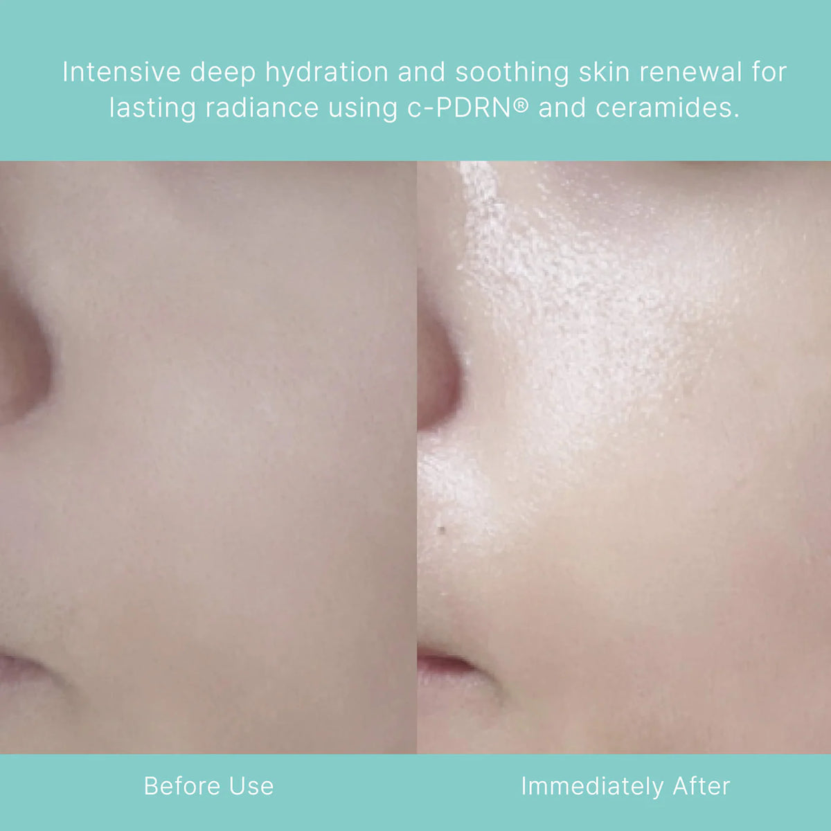 Turnover Mask c-PDRN® 5-Pack for Uneven Texture & Brightening Dull Skin - Rejuran /