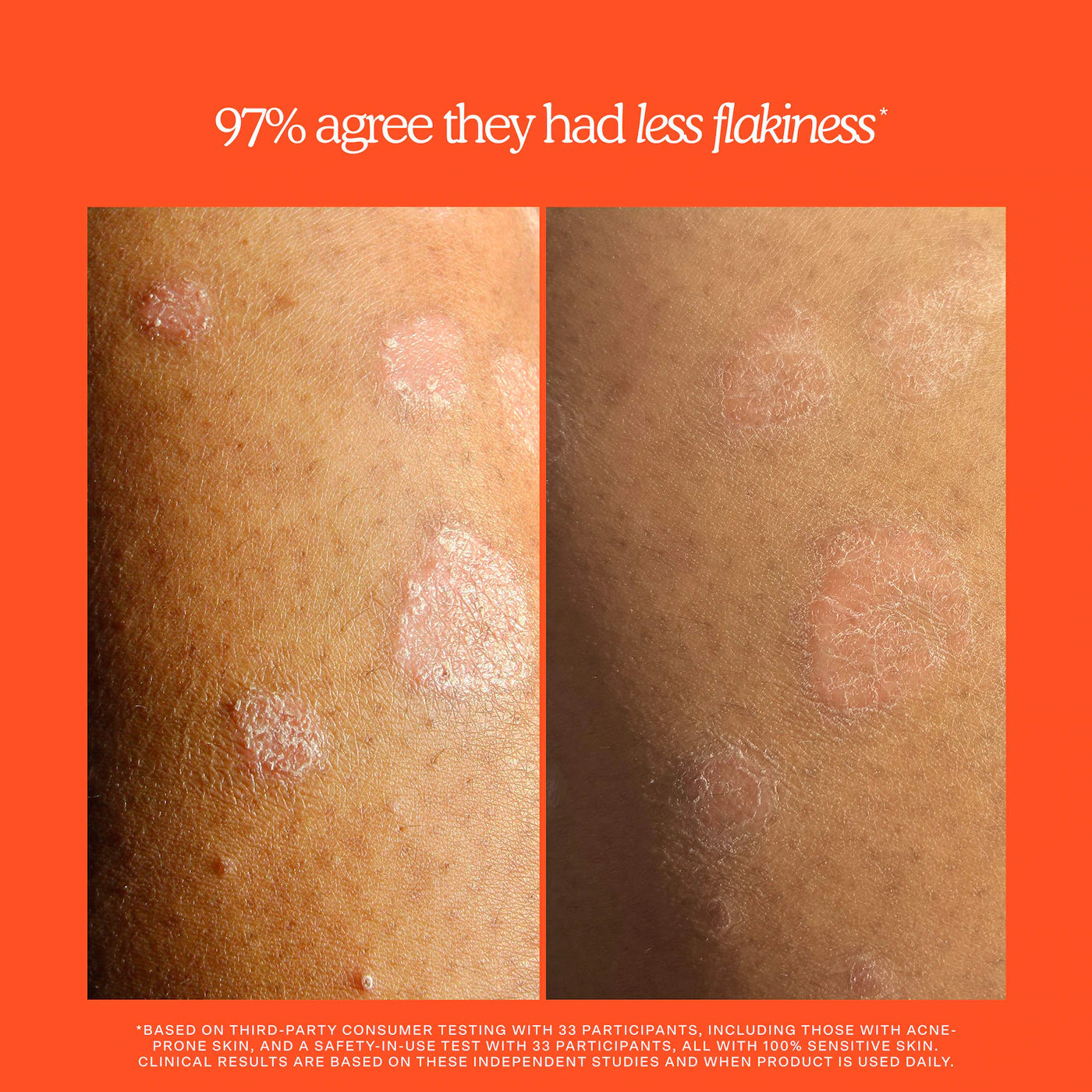 *PREORDEN: SOS Rescue + Relief Body Wash Treatment - Tower 28 / Gel de ducha que minimiza acné, irritación y enrojecimiento