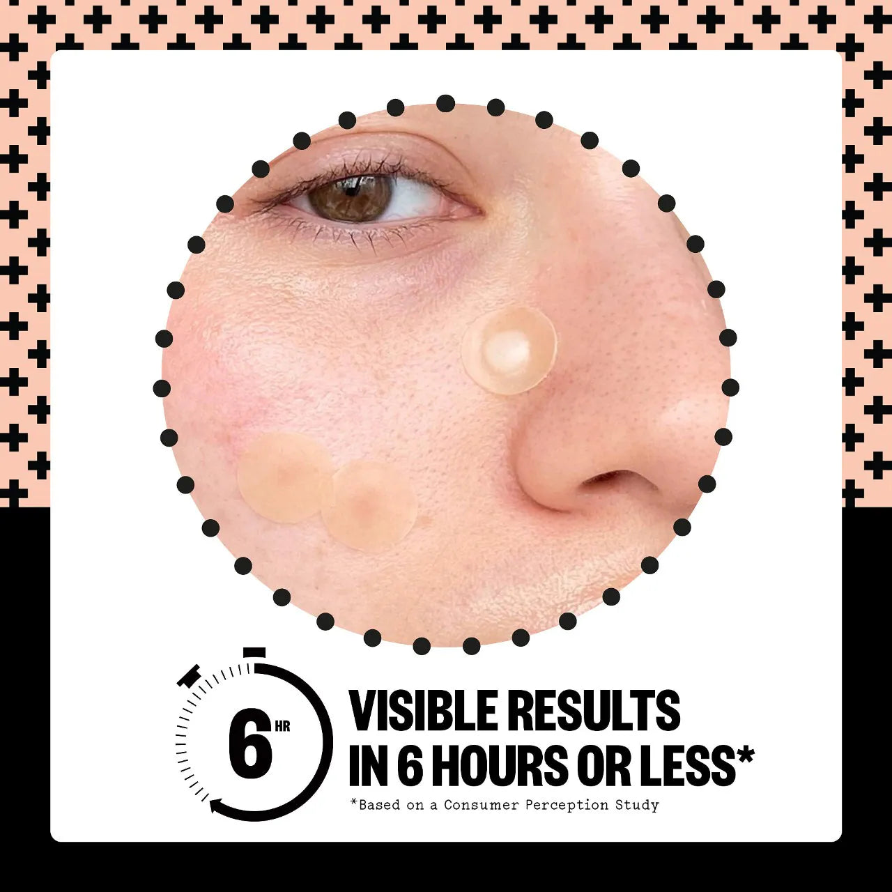 *PREORDEN: Salicylic Acid Acne Healing Dots - Peace Out / Parché para ácne