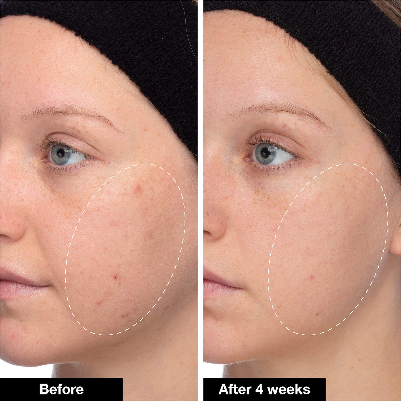 *PREORDEN: Slushy Serum - INNBEAUTY PROJECT / Suero hidratante