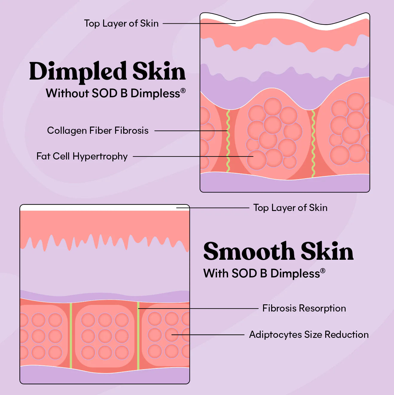 Smooth Capsules - lemme / Cápsulas de apoyo a la celulitis y suavizantes de la piel