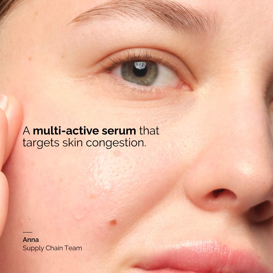 Balancing & Clarifying Serum for Blemish-Prone Skin - The Ordinary / Suero para poros y brillo