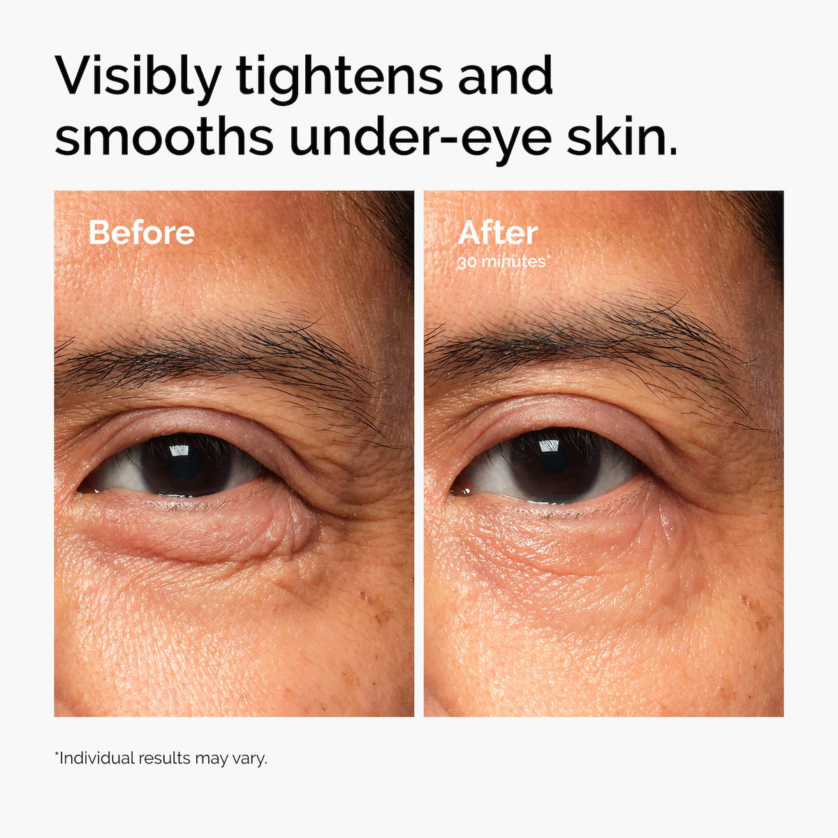 *PREORDEN: Lacto-PDRN* 4% + B9 Eye Cream - The Ordinary / Contorno de ojos reafirmante