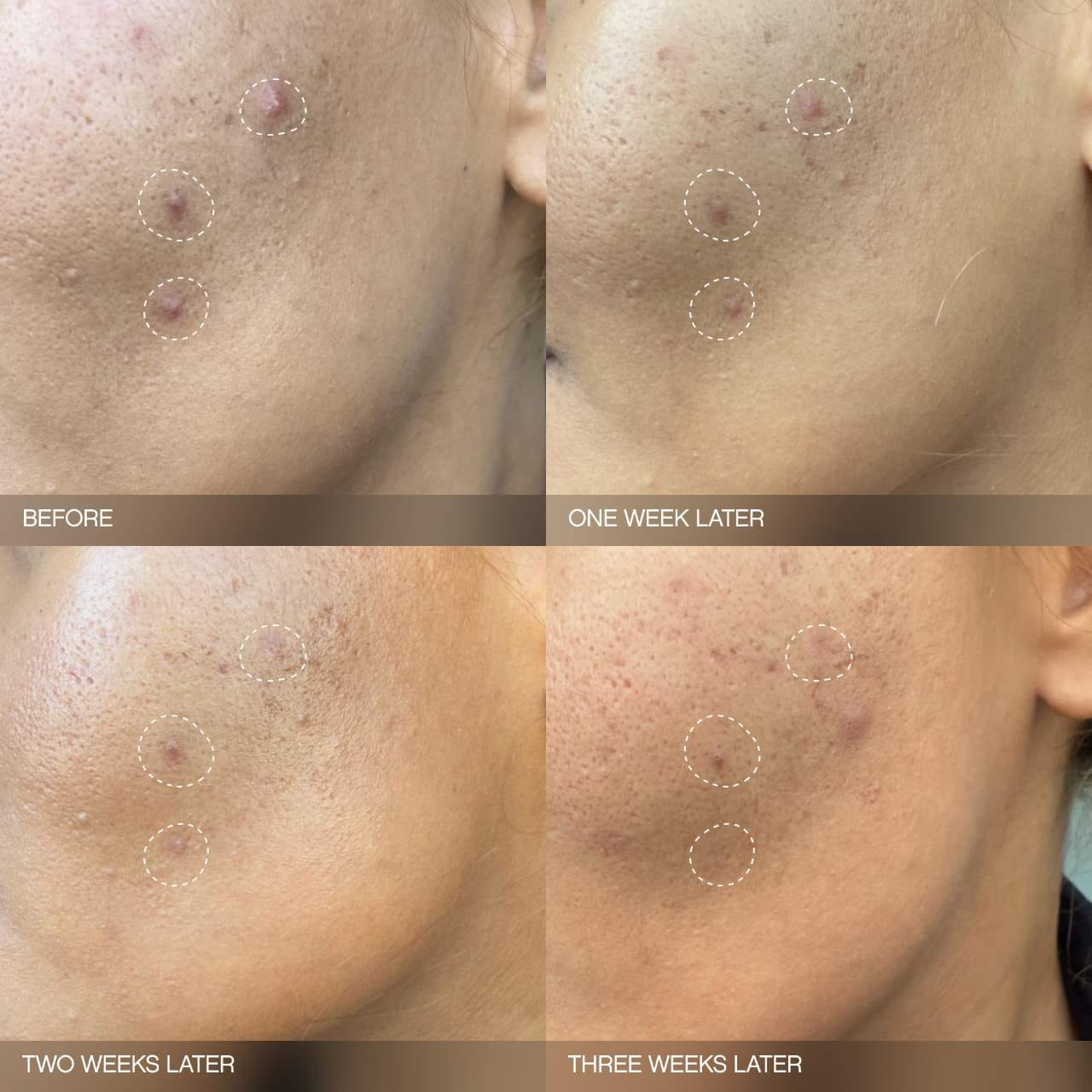 *PREORDEN: Faded Brightening Serum for Dark Spots and Discoloration (UNSCENTED) - Topicals / Suero para hiperpigmentación sin aroma