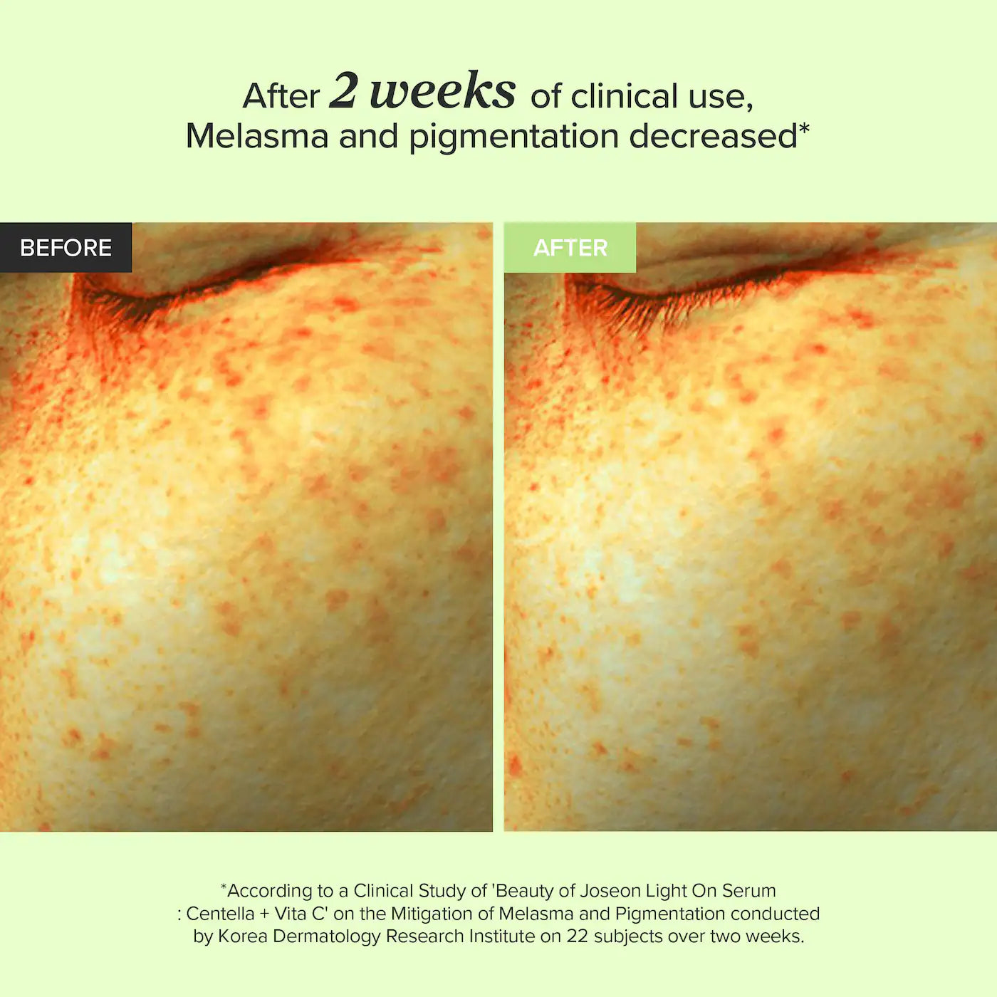 *PREORDEN: Light On Vitamin C Serum For Brightening & Dark Spot Correction - Beauty of Joseon / Sérum de vitamina C para iluminar y corregir manchas oscuras.