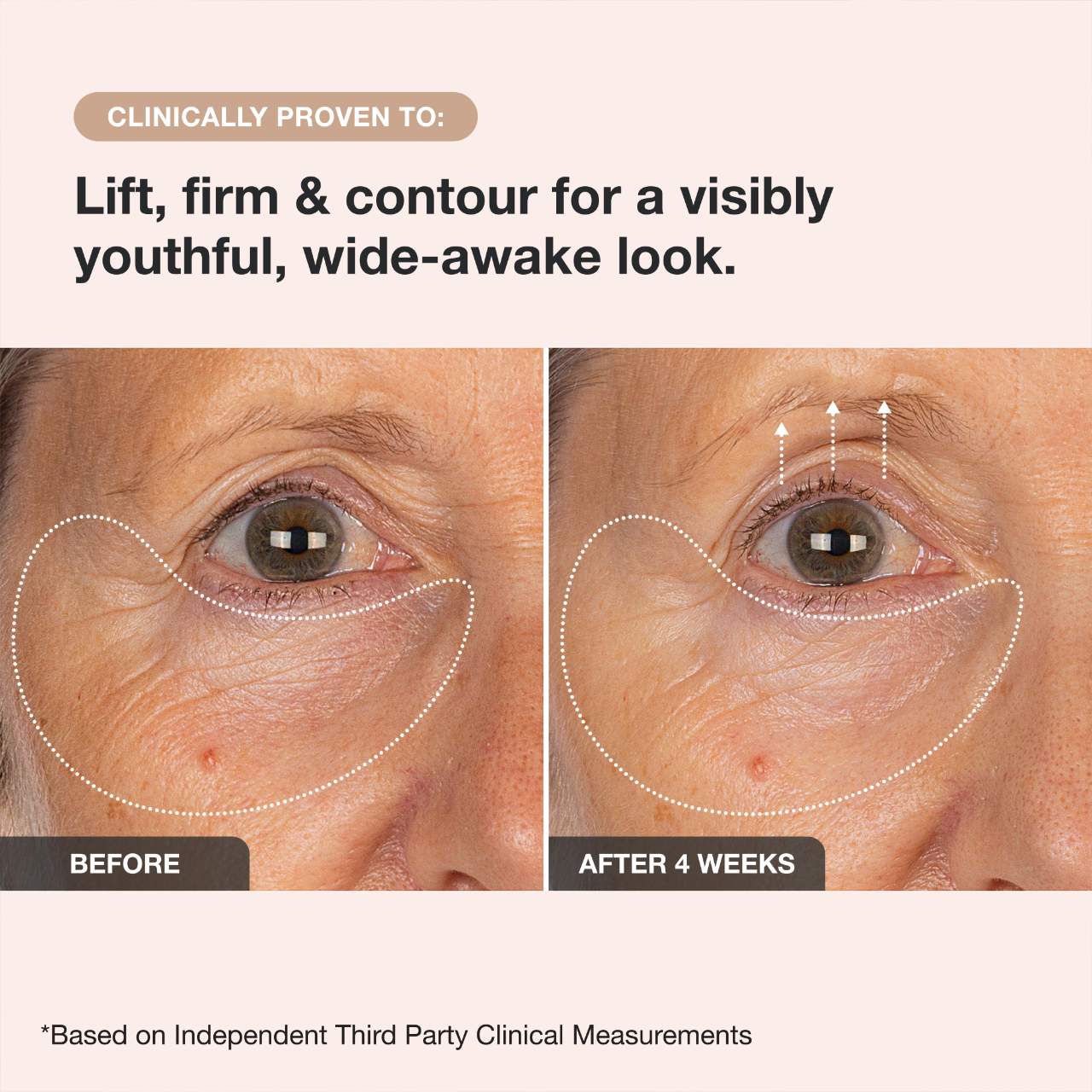 Extreme Cream Eye Firming & Contouring Refillable Eye Cream - iNNBEAUTY PROYECT / Crema de ojos para la hinchazón, arrugas y flacidez