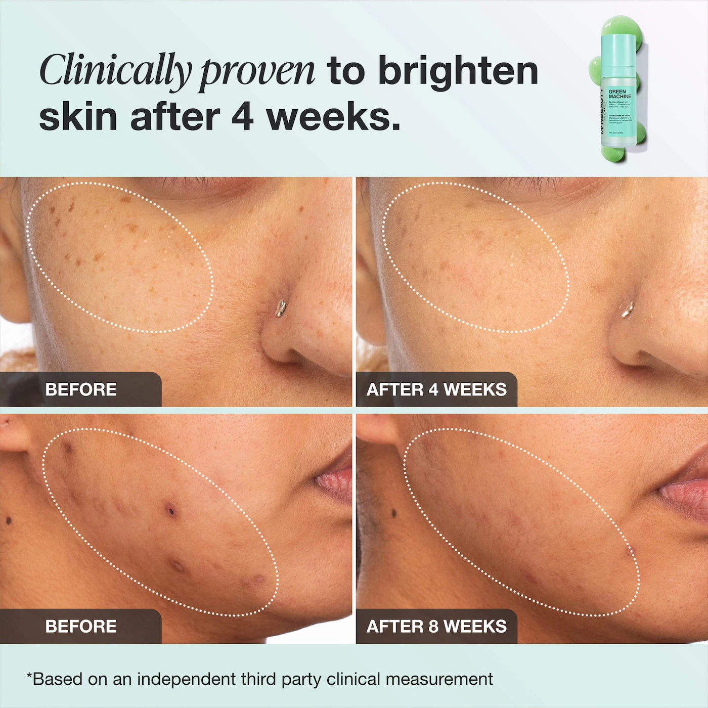 Green Machine Vitamin C Dark Spot & Hyperpigmentation Serum - iNNBEAUTY PROYECT / Serum multivitaminico para manchas y elasticidad