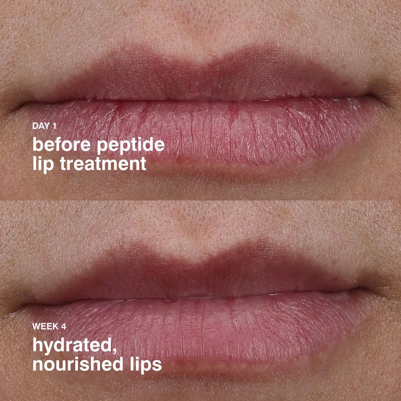 peptide lip treatment - RHODE / Bálsamo labial nutritivo