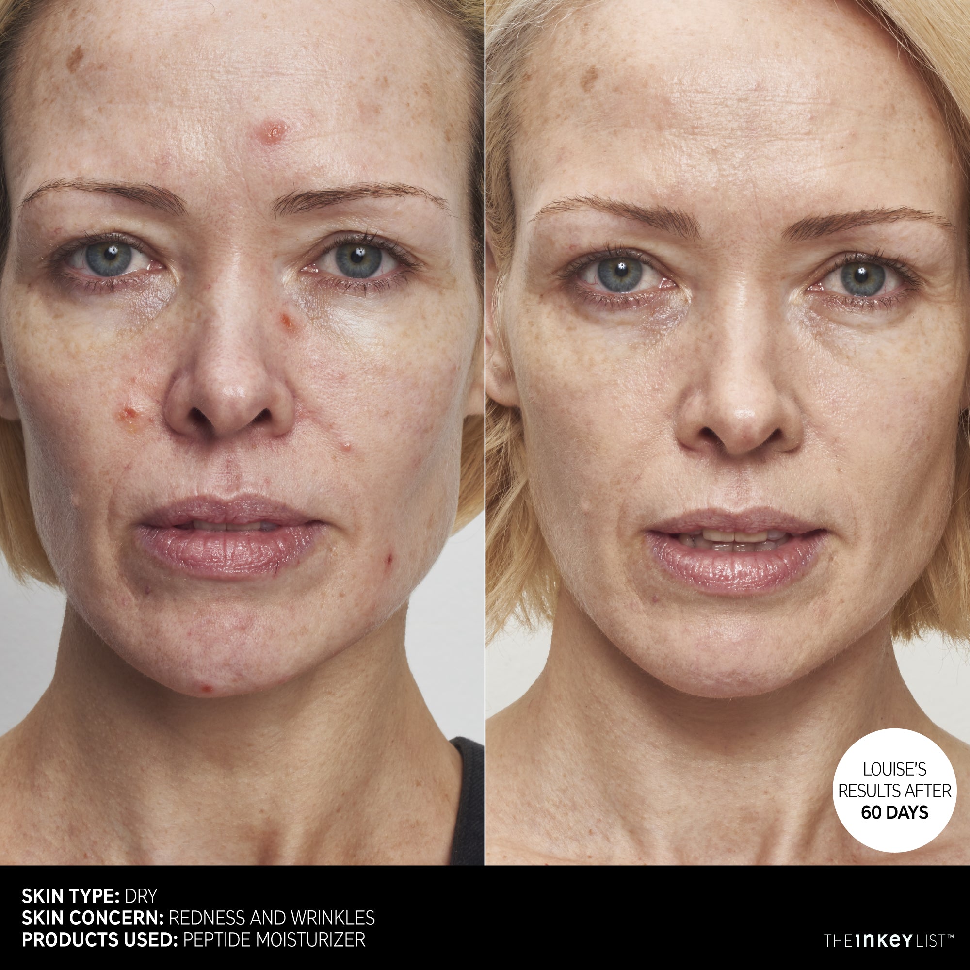 *PREORDEN: Peptide Moisturizer - The inkey list / Humectante para lineas finas y arrugas con péptidos