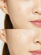 Acne Pimple Master Patch - COSRX / Parche para granitos