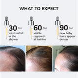 *PREORDEN: Youth Juice Collagen Scalp Serum for Thinning Hair  - COLOR WOW / Suero para la caída del cabello