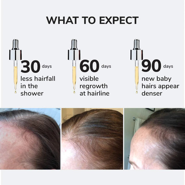 *PREORDEN: Youth Juice Collagen Scalp Serum for Thinning Hair  - COLOR WOW / Suero para la caída del cabello