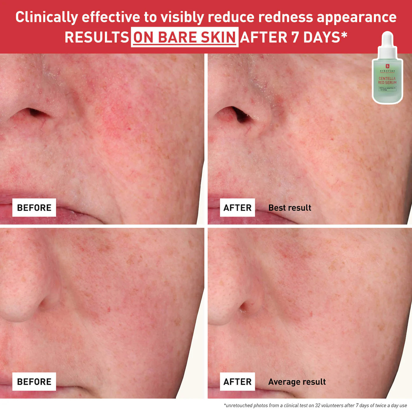 Centella Red Serum for Visible Redness & Immediate Soothing Effect on Sensitive Skin - Erborian / Sérum de Centella Roja para el enrojecimiento y pieles sensibles.