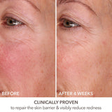 *PREORDEN: DermInfusions™ Fill + Repair Serum with Hyaluronic Acid - Dr. Dennis Gross Skincare / Suero que rellena visiblemente las lineas