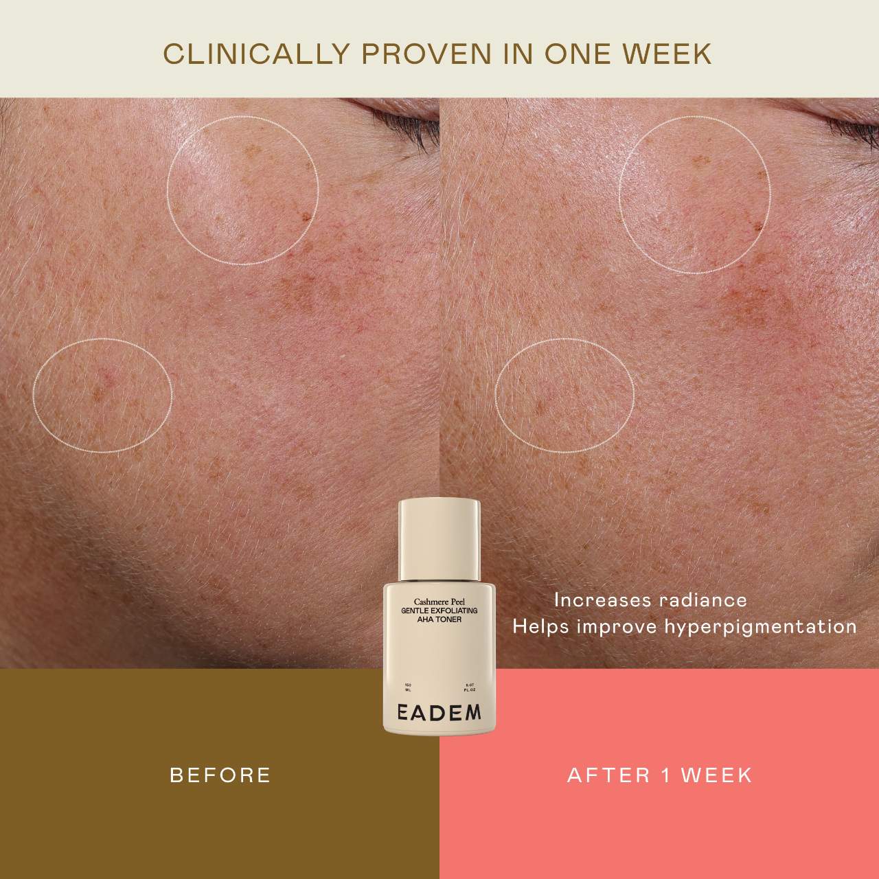 Cashmere Peel Gentle AHA + PHA Exfoliating Toner with 9% Lactic, Azelaic, Tranexamic Acids - EADEM  / Exfoliante para poros