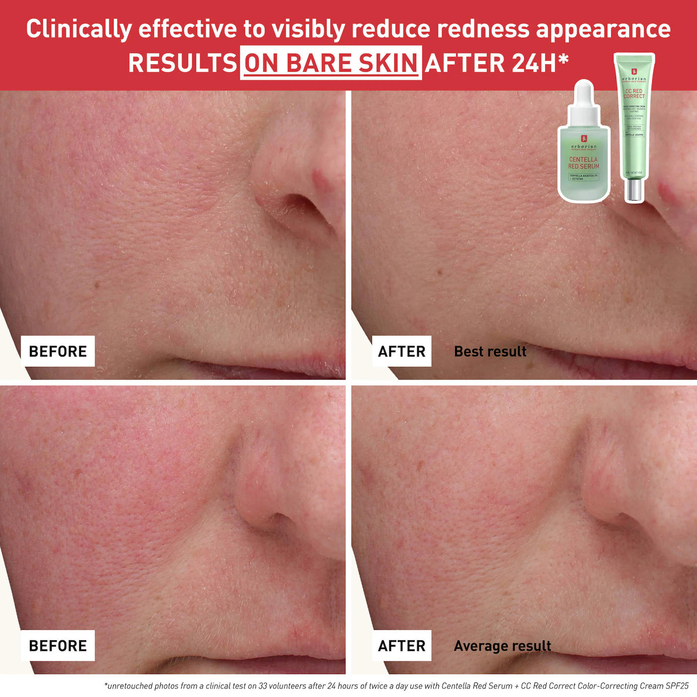 *PREORDEN: Centella Red Serum for Visible Redness & Immediate Soothing Effect on Sensitive Skin - Erborian / Sérum de Centella Roja para piel sensible