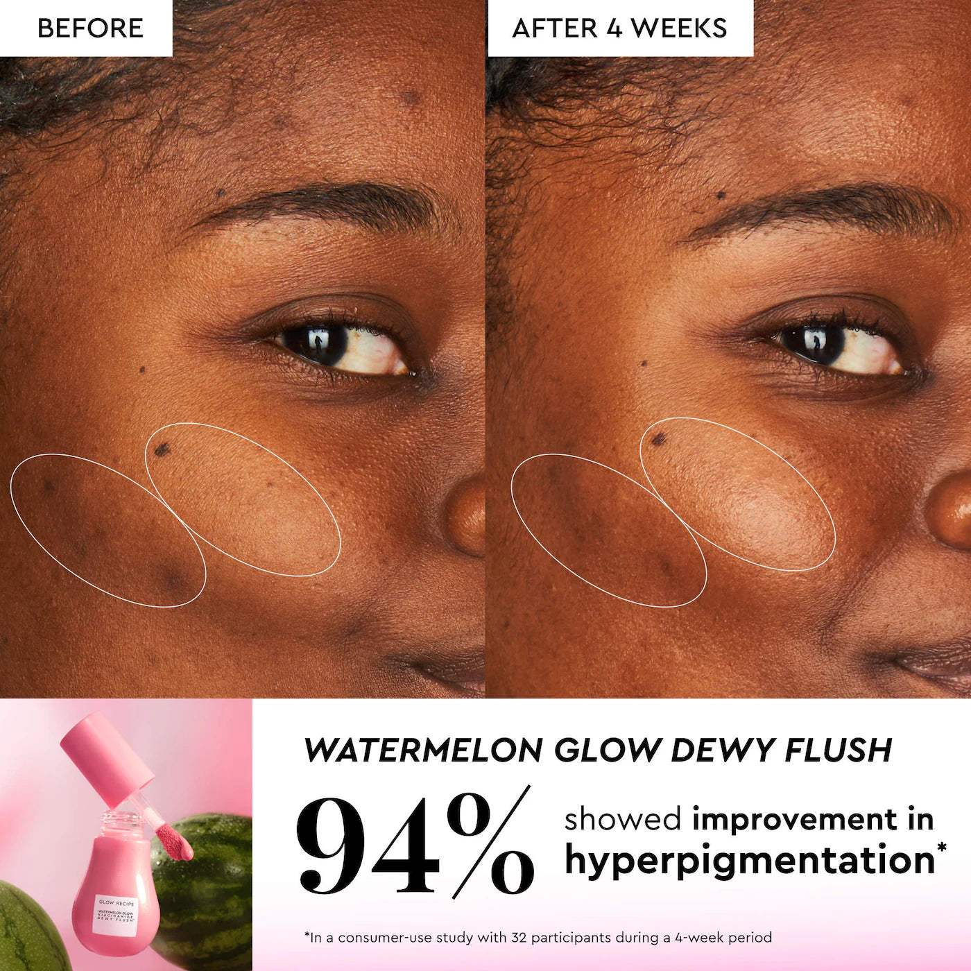 ^PREORDEN: Glow Recipe X Beautyblender Watermelon Glow Bestsellers - Glow Recipe / Set de 4 piezas para el cuidado del rostro