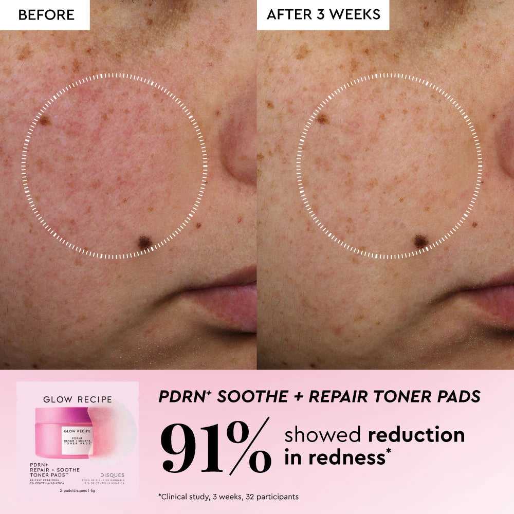 *PREORDEN: Korean Toner Pad Skin Care Kit for Pores, Dark Spots, and Skin Barrier Repair - Glow Recipe / Set de cuidado facial coreano