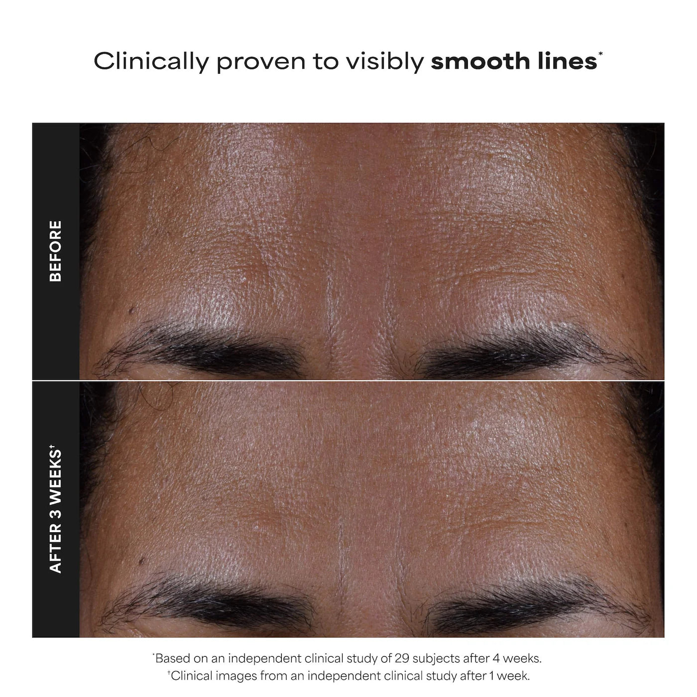 *PREORDEN: Home & Away Kit with 2% BHA Exfoliating Toner & Toner Pads for Clear Skin - Paula’s Choice / Acné, poros, puntos negros, textura