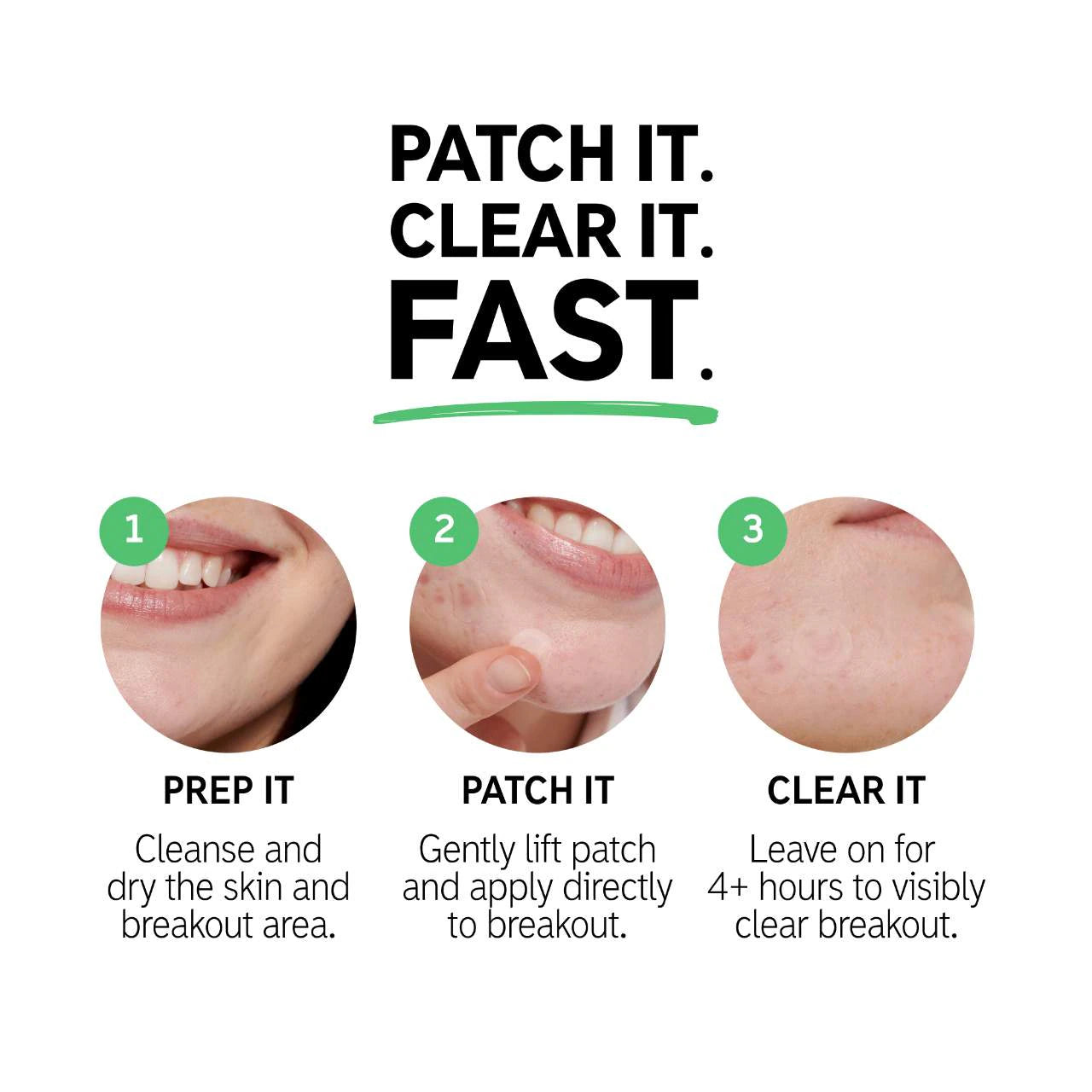 *PREORDEN:Hydrocolloid Invisible Pimple Patches - The inkey list / Parches para granitos