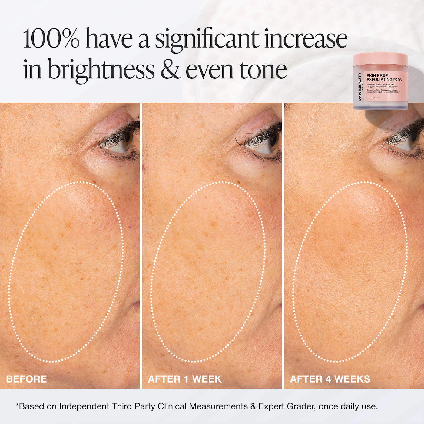 *PREORDEN: Skin Prep Brightening & Exfoliating Pads with Glycolic Acid - iNNBEAUTY PROYECT / Almohadillas exfoliantes