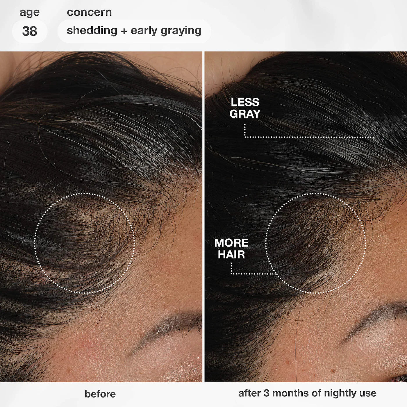 *PREORDEN: FutureIQ™ Hair Longevity Serum for Graying, Thinning, & Scalp Aging - K18 Biomimetic Hairscience / Sérum Nocturno para Canas y Caída del Cabello