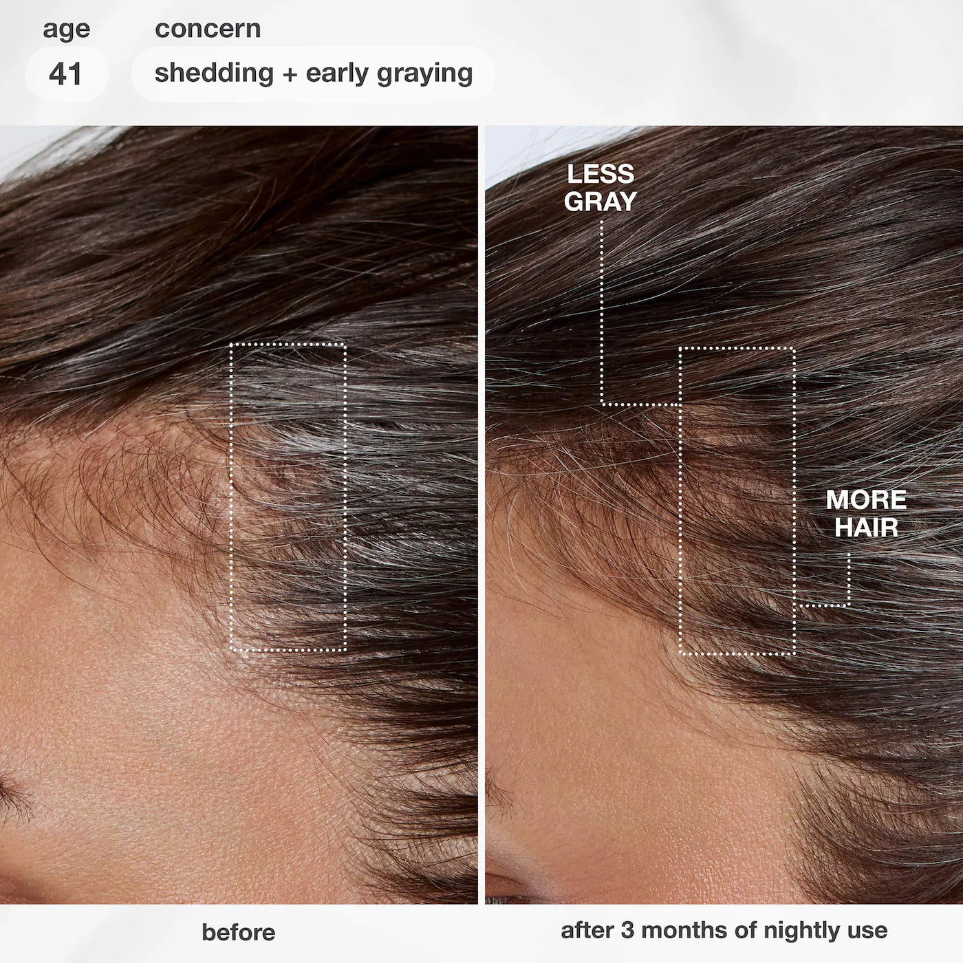 *PREORDEN: FutureIQ™ Hair Longevity Serum for Graying, Thinning, & Scalp Aging - K18 Biomimetic Hairscience / Sérum Nocturno para Canas y Caída del Cabello