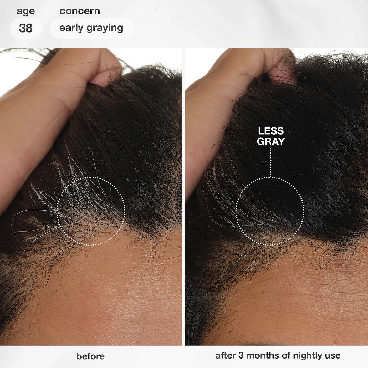 *PREORDEN: FutureIQ™ Hair Longevity Serum for Graying, Thinning, & Scalp Aging - K18 Biomimetic Hairscience / Sérum Nocturno para Canas y Caída del Cabello