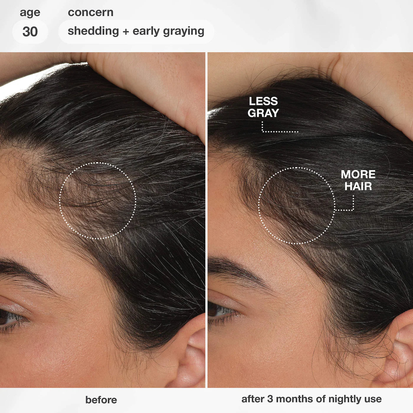 *PREORDEN: FutureIQ™ Hair Longevity Serum for Graying, Thinning, & Scalp Aging - K18 Biomimetic Hairscience / Sérum Nocturno para Canas y Caída del Cabello