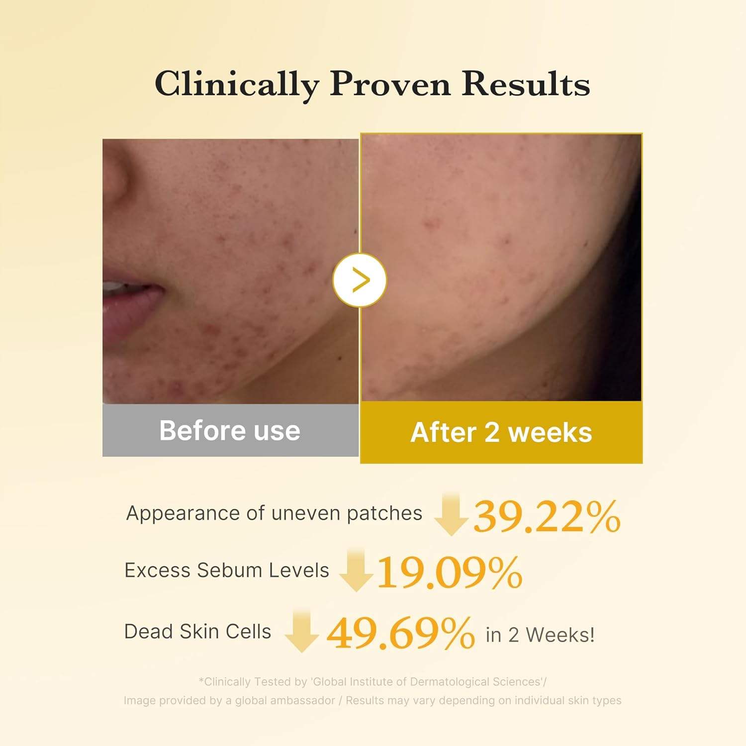 Kojic Acid Tumeric Toner Pad - Medicube / Almohadillas para piel radiante