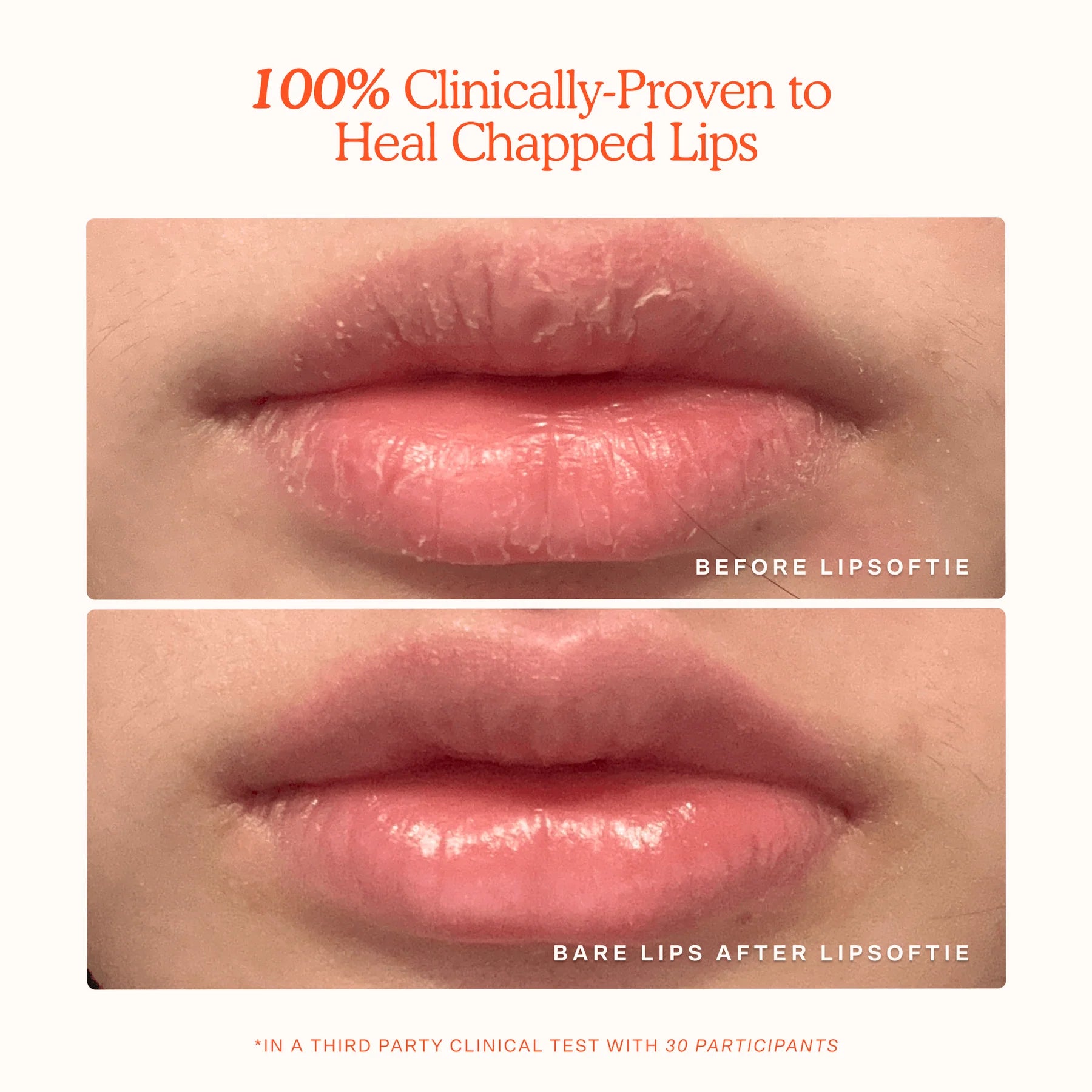LipSoftie™ Lip Treatment Trio - Tower 28 / Set 3 pzas minis labios