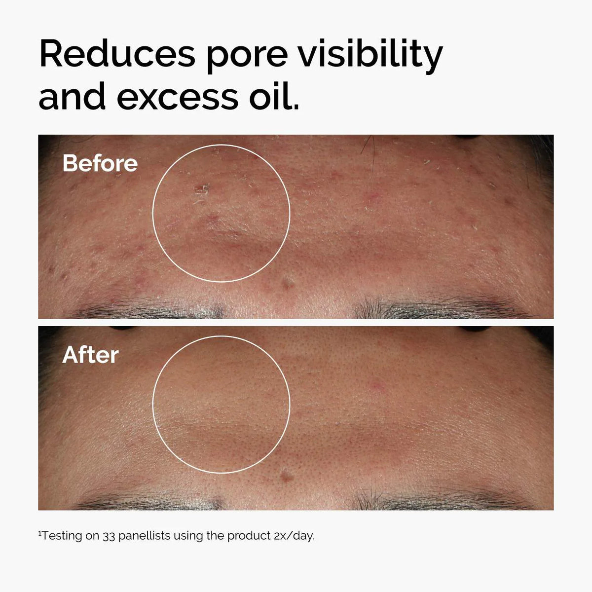 Niacinamide 10% + Zinc 1%  Serum for Oily Skin - The Ordinary / Poros y Control de Grasa