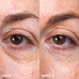 *PREORDEN: Paula's Choice C5 Super Boost Vitamin C Eye Cream - Paula’s Choice / Crema que reduce la hinchazón de los ojos