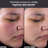 *PREORDEN: Gold Standard 2% BHA Jumbo & Mini Set for Clear Skin - Paula’s Choice / Kit acné, poros, puntos negros, textura