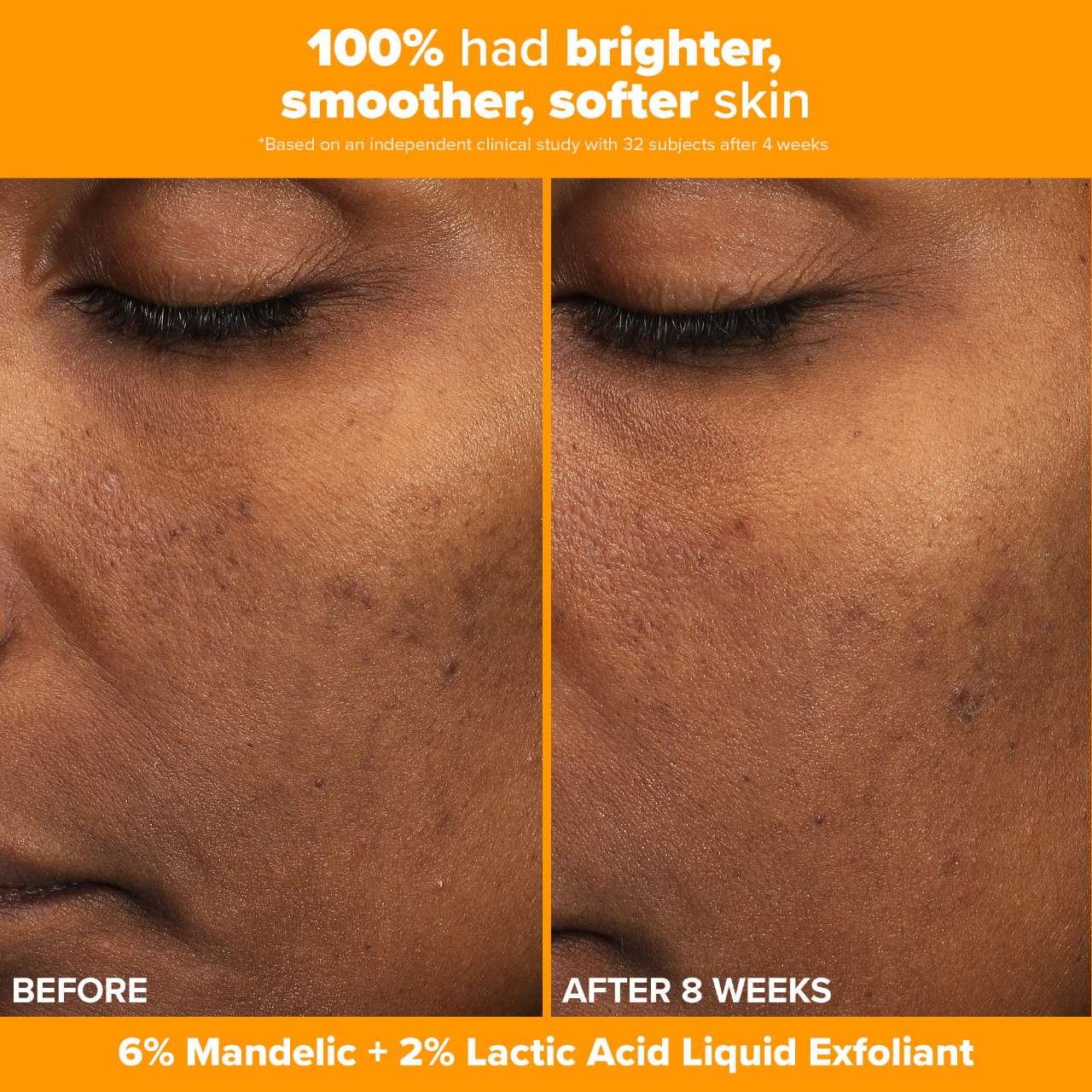 *PREORDEN: Brighter Days Ahead Kit with Vitamin C and AHA for Discoloration - Paula’s Choice / Set 3 pzas iluminador