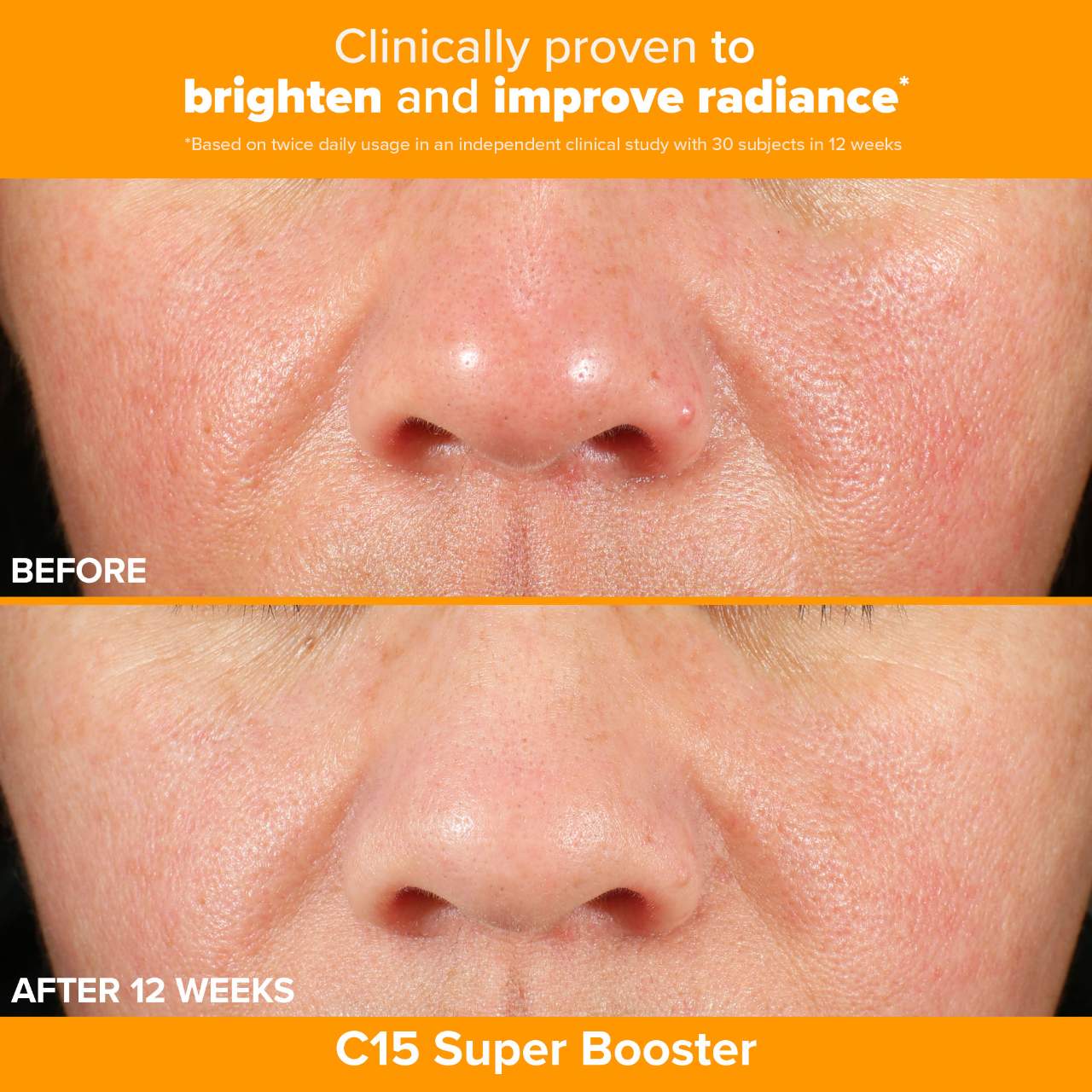 *PREORDEN: Brighter Days Ahead Kit with Vitamin C and AHA for Discoloration - Paula’s Choice / Set 3 pzas iluminador