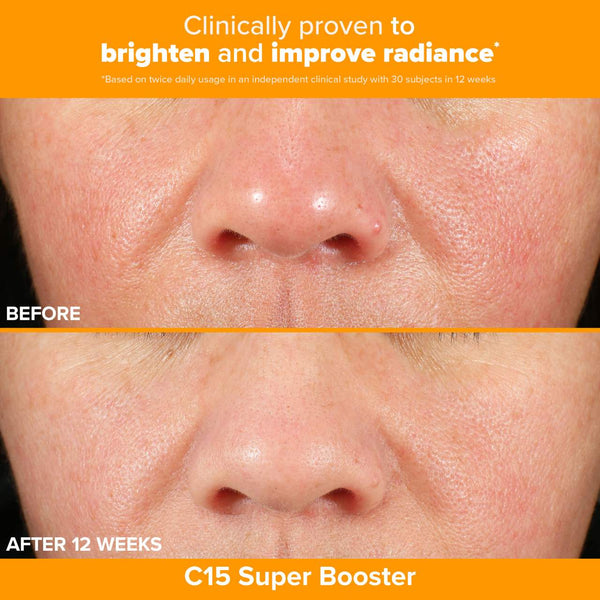 *PREORDEN: Brighter Days Ahead Kit with Vitamin C and AHA for Discoloration - Paula’s Choice / Set 3 pzas iluminador